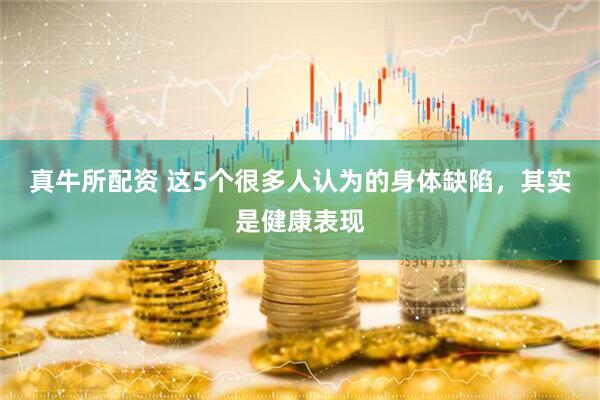 真牛所配资 这5个很多人认为的身体缺陷，其实是健康表现